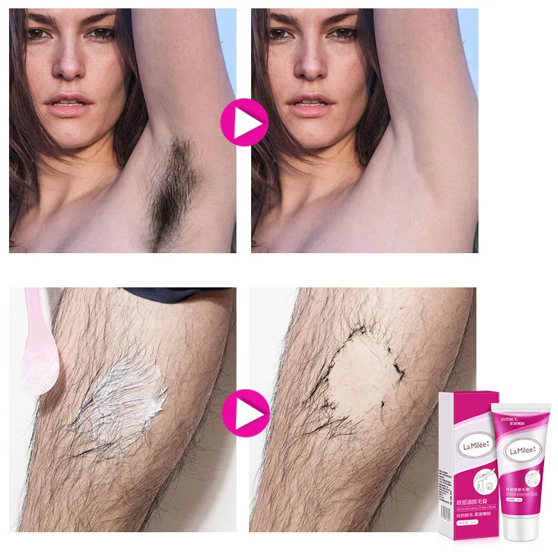 

Explosion recom men dation