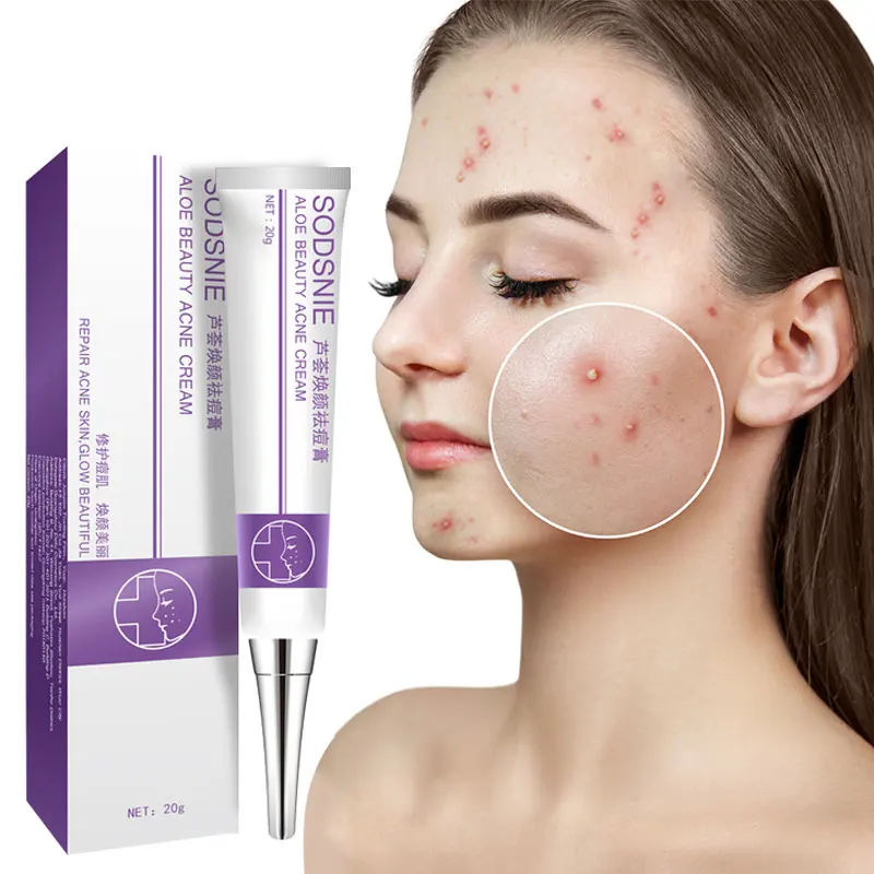 

Effective Acne Removal Cream Acne Treatment Fade Acne Spots Oil Control Shrink Pores Whitening Moisturizing Acne Cream Skin Care