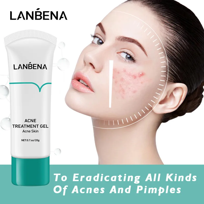 

LANBENA Acne Treatment Cream Remove Blackheads Pimples Gel Face Clean Effective Fade Marks Scars Refreshing Repair Damaged Skin