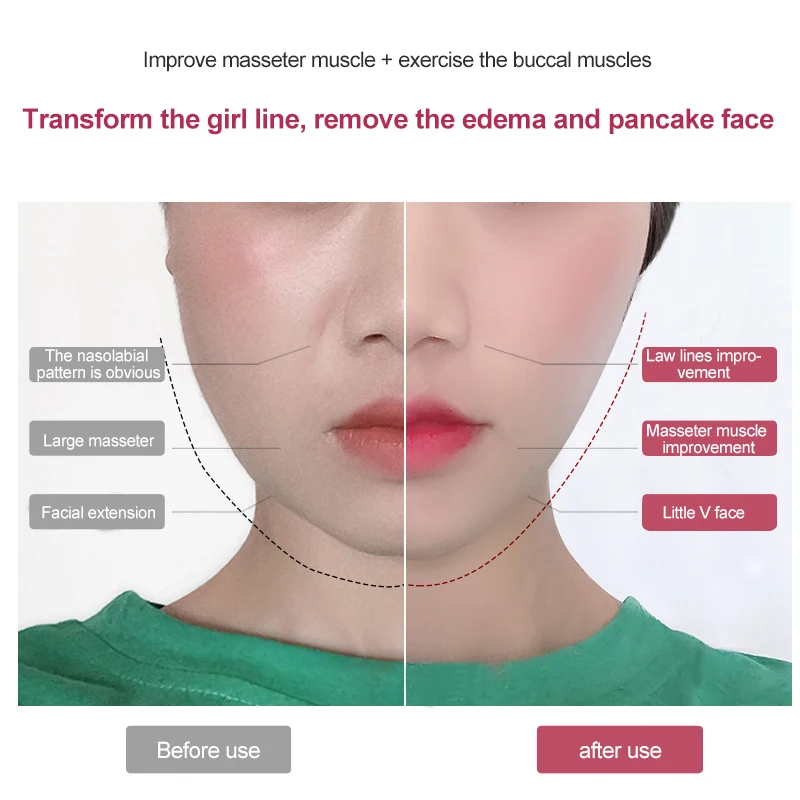 

Electric V-Face Lifting Instrument LED Double Chin Strap Facial Slimming Reducer Anti Aging Wrinkles Skin Care Face Care Tools
