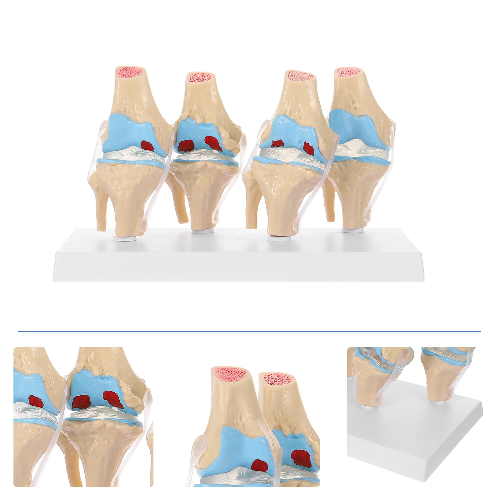 

Human Knee Joint Model Human Anatomy Replica Set Osteoarthritis Knee Joint Model