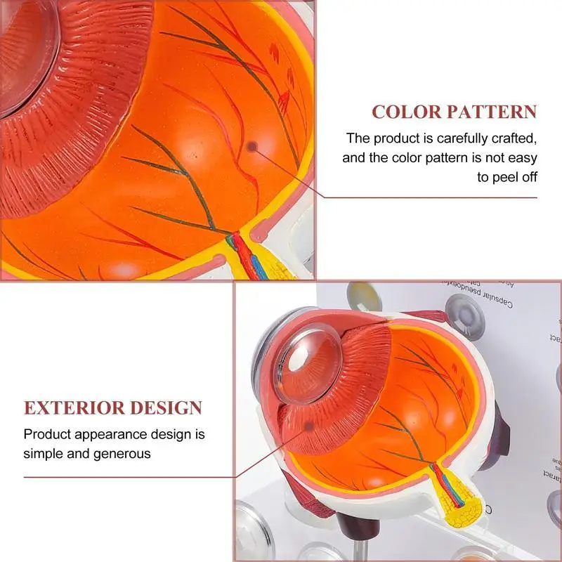 Демонстрационный набор для демонстрации болезни глаз от роговицы | Канцтовары