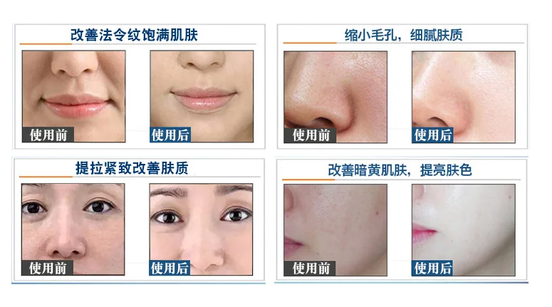 

Anti-sugar d rin k spots whitening and brightening complexion improving dark yellow anti-age health care 30 / box