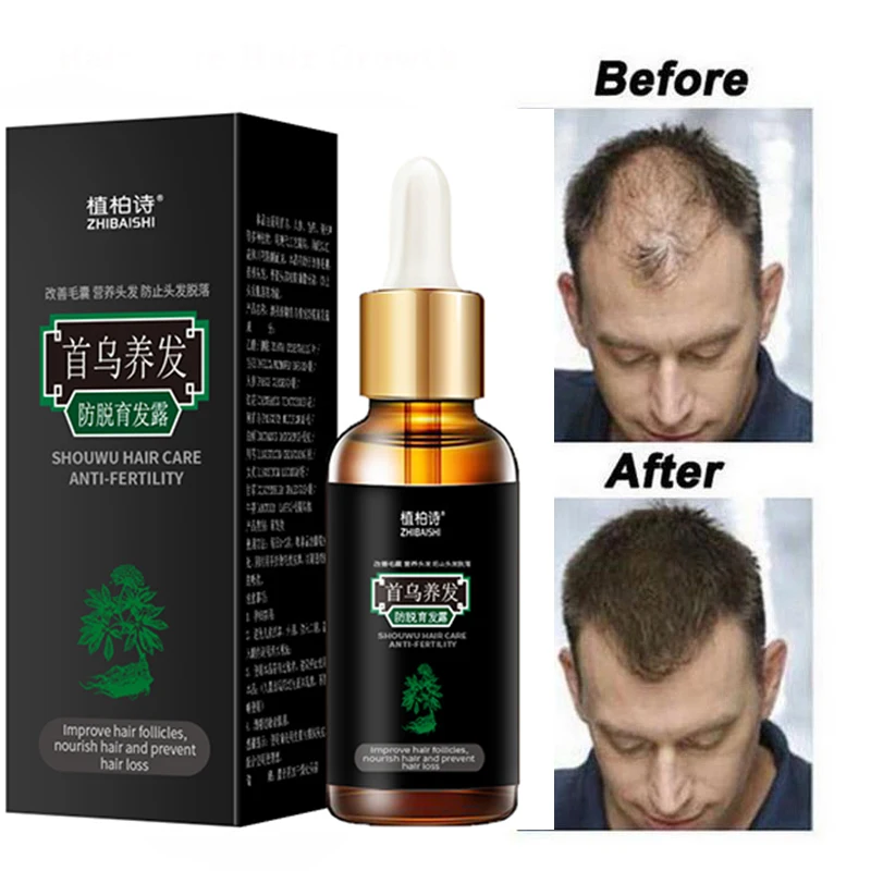 

Hair Care Hair Growth Essential Oils Essence Grow Hair Fluid Prevent Hair Loss Health Care Beauty Dense Hair Growth Serum