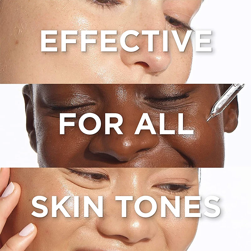 Эссенция лактобионовой кислоты Alliwise эффективное антивозрастное увлажняющее