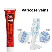 10pcs varicose veins treatment cream effective cure vasculitis phlebitis spider veins pain varicosity angiitis ointment 30g
