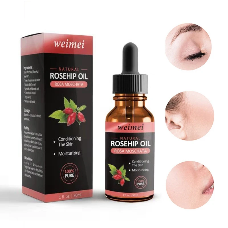 Organic Rosehip Seed Oil For Face-Pure Cold Pressed Facial Natural Non-Greasy Moisturizing Serum | Красота и здоровье