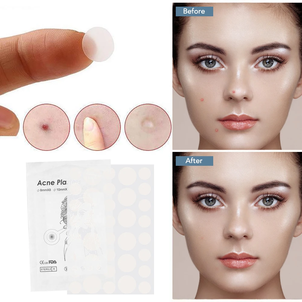 Патчи Гидроколлоидные от акне для быстрого заживления прыщей 1 упаковка 36 шт. |