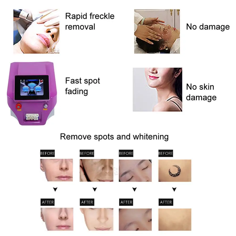 

Picosecond Laser Beauty Machine Tattoo Pigment Removal Rejuvenation Firming Skin Remove Blackhead Whitening Spotting Instrument