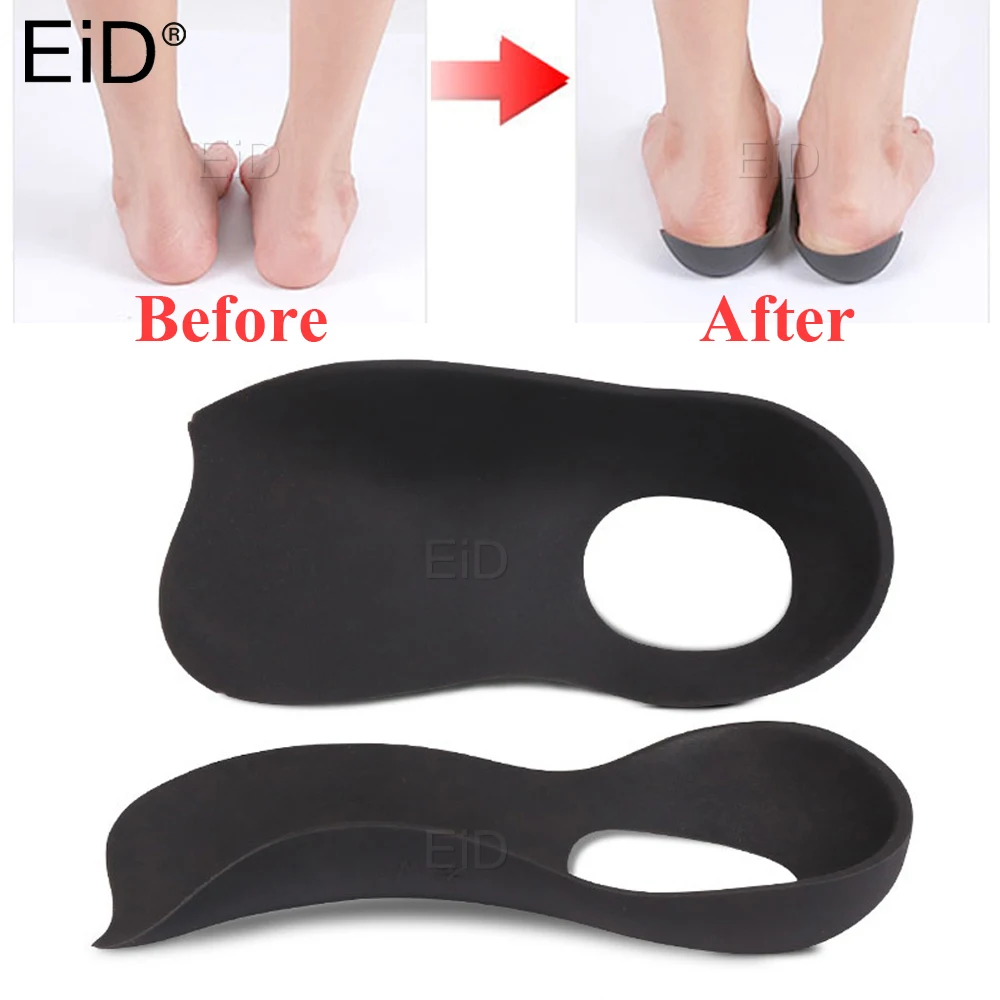 

Unisex O/X Legs Correction Insoles Orthopedic Insole Arch Support Orthoses Pad Massaging Shoe Insert Foot Care Flat Foot Shoe