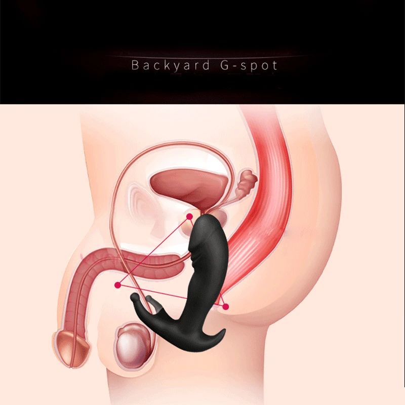 Yunman 3 Speeds +10 Frequancy Remote Control Prostate Massager Anal Vibrating Butt Plug Sex Toys For Man Masturbator Gay | Красота и