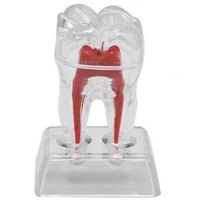 large tooth molar model separable teaching demonstration model transparent dentistry material lab teeth model