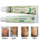 Мазь Zudaifu крем от псориаза для лечения экземы, уход за телом, псориаз, дерматит экзему, крем антибактериальный