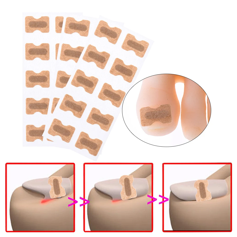 8/10 шт. дышащие наклейки для исправления вросших ногтей |