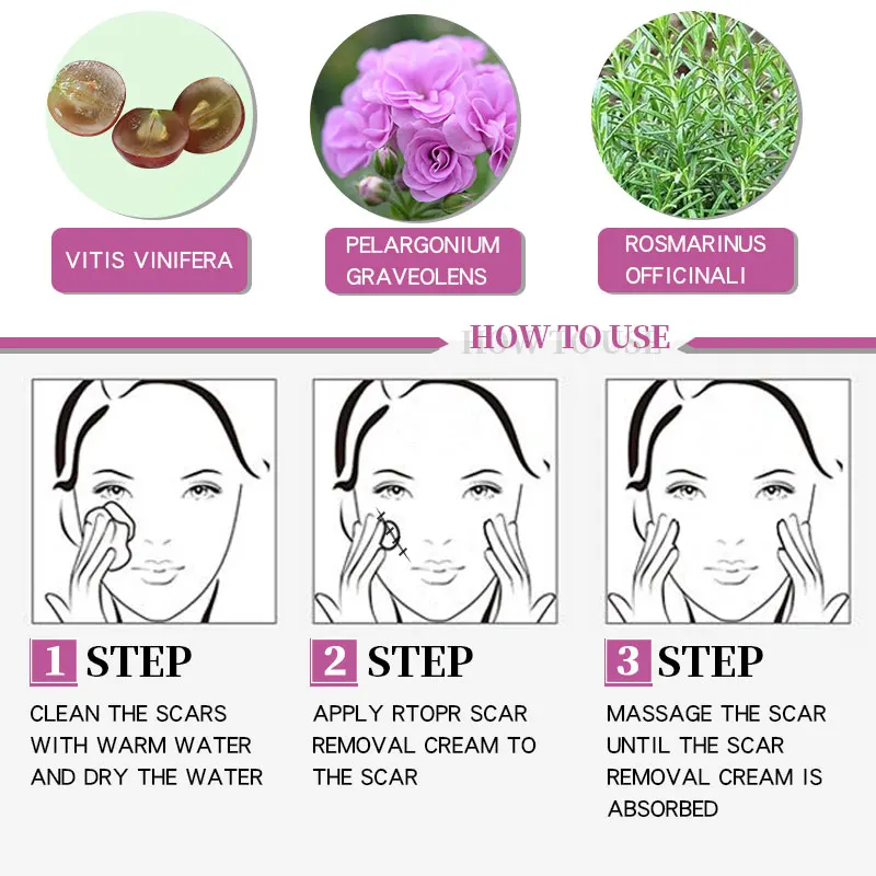 20G Remover Cream Acne Scar Stretch Marks Skin Repair Face Cream Acne Spots Acne Treatment Blackhead Whitening Cream Skin Care