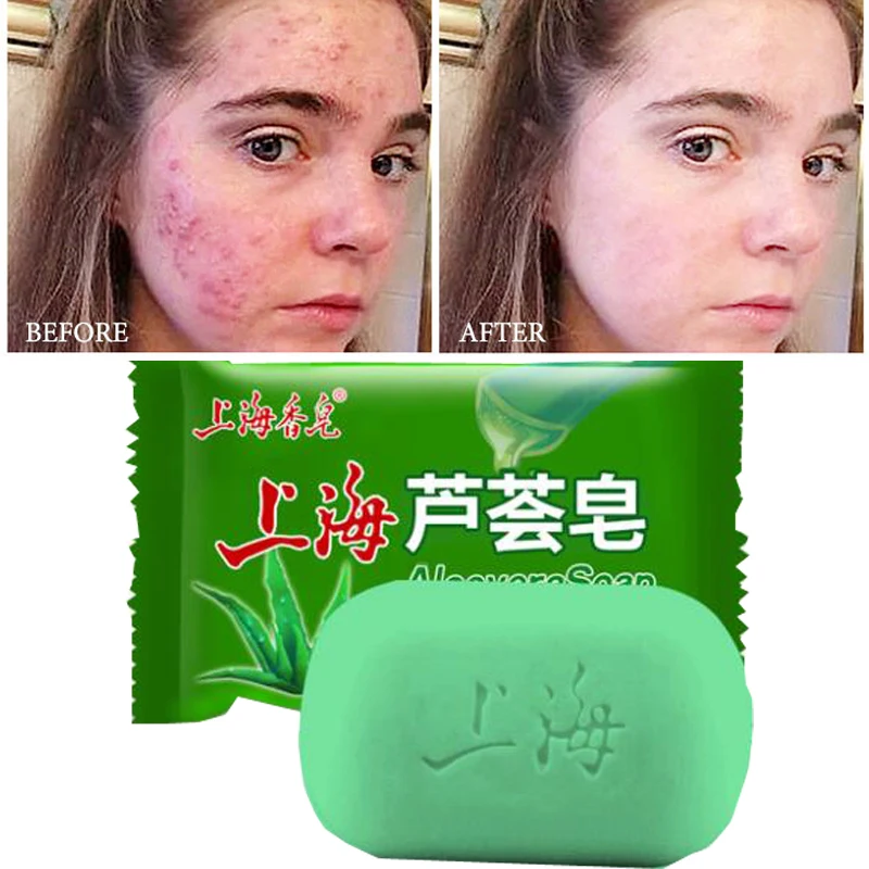 99% успокаивающий гель с алоэ средство для ухода за кожей увлажняющее мыло тела и