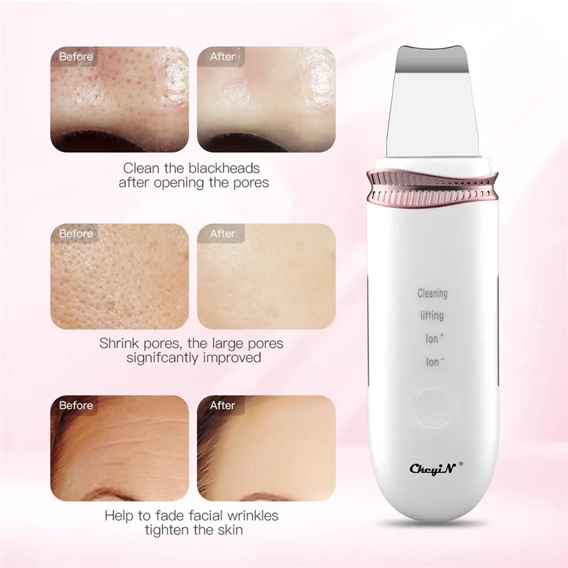 

Ultrasonic Skin Scrubber Facial Pore Cleaner Blackhead Removal Skin Peeling Cavitation Face Spatula EMS Lift Beauty Machine