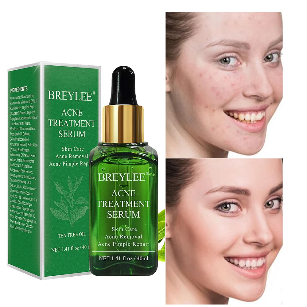 

40 ml Acne Treatment Serum Moisturizing Remove Pimple Anti-wrinkle Anti-aging Shrink Pores Soothing Sensitive Muscle Face Care