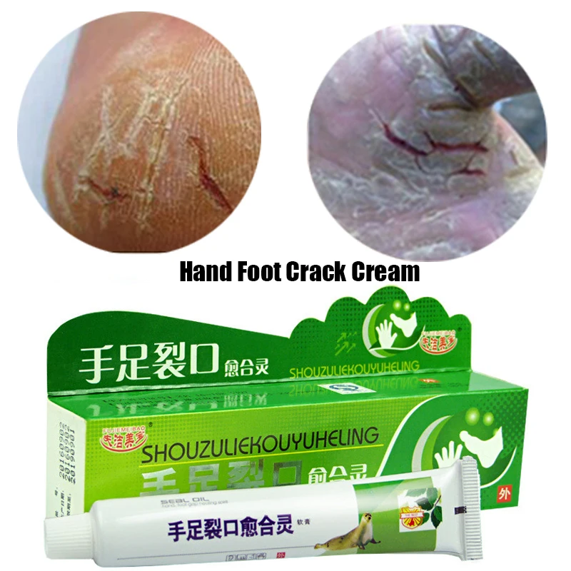 

Powerful Hand Foot Crack Cream Heel Chapped Peeling Foot And Hand Repair Anti Dry Crack Skin Care Chinese Ointment