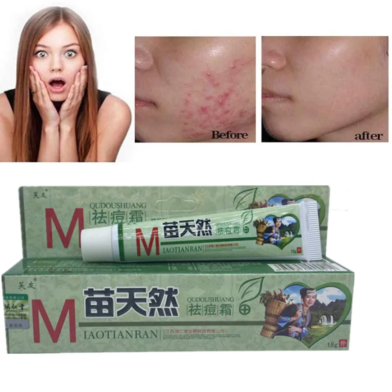 

18g Acne Removal Cream Sterilization and Mite Removal Moisturizing Skin Cream Care Moisturizing Moisturizing Cream