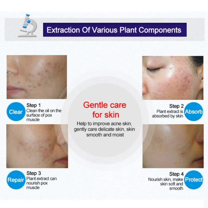 

Acne Removal Cream Acne Treatment for Lighten Acne Shrink Po