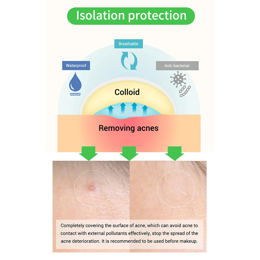 BREYLEE лица акне точки Гидроколлоидные пятна кожи патч ясно излучают маски для