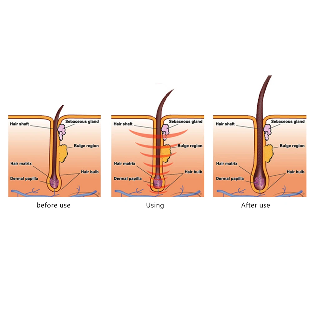Алопеция от выпадения волос жидкая поврежденная восстанавливающая быстро