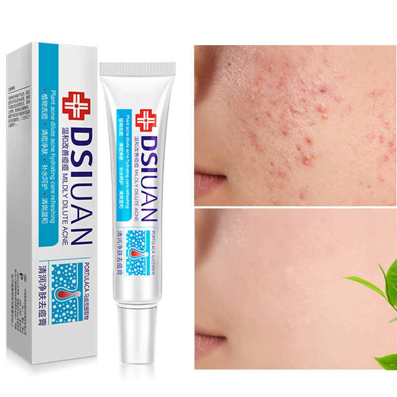 

Женский крем для лечения шрамов от акне