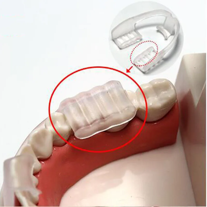 

Anti-Snoring Dental Teeth Guard Prevent Night Teeth Tooth Grinding Sleep Aid Bruxism Splint help to Cultivate Good Heathy Habit