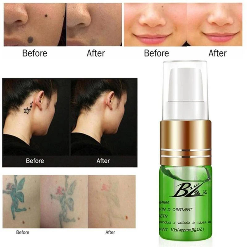 

1 Pcs Tattoo Recovery Aftercare Serum Skin Tag Removal Ointment Top Eyebrow Tattoo Repairing Cream Tattoo Ice Essence Products