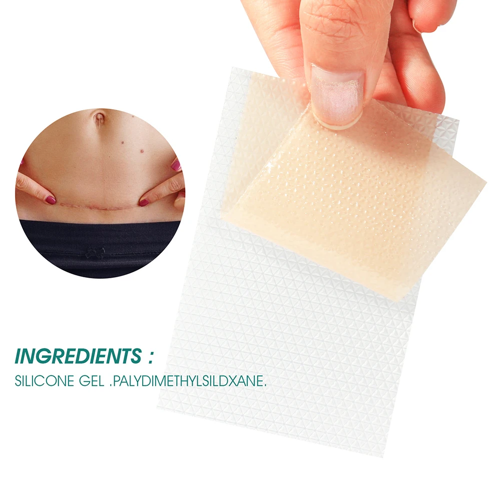 

Surgical Scar Removal Patch Trauma Burn Sheet Therapy Skin Repair Stretch Marks Remove Acne Gel Treatment Silicone Stickers
