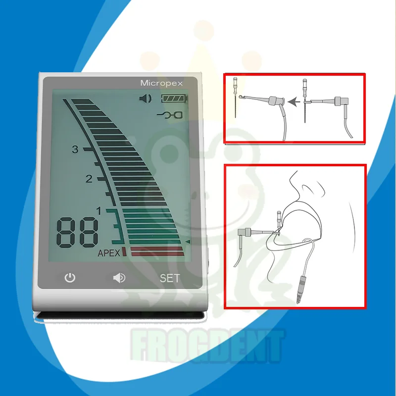 Стоматологическое оборудование для эндонтического лечения стоматологический
