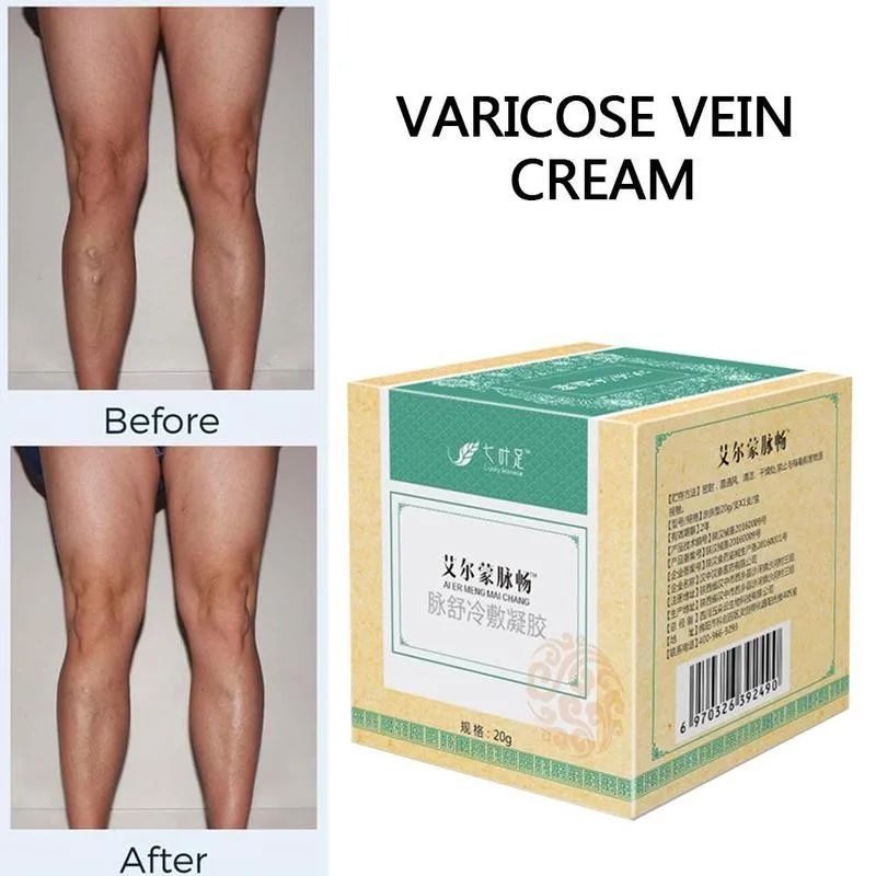 Фотоэлемент лечения варикозного расширения вен медицинский паук китайская