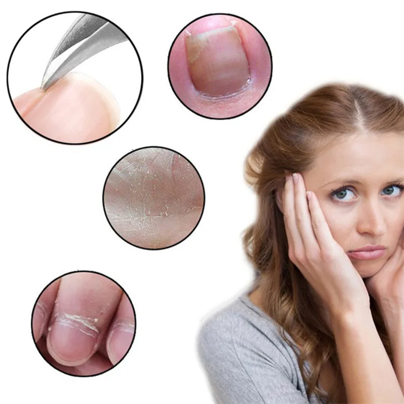 Кусачки для ногтей кусачки коррекции удаления омертвевшей кожи средство грязи