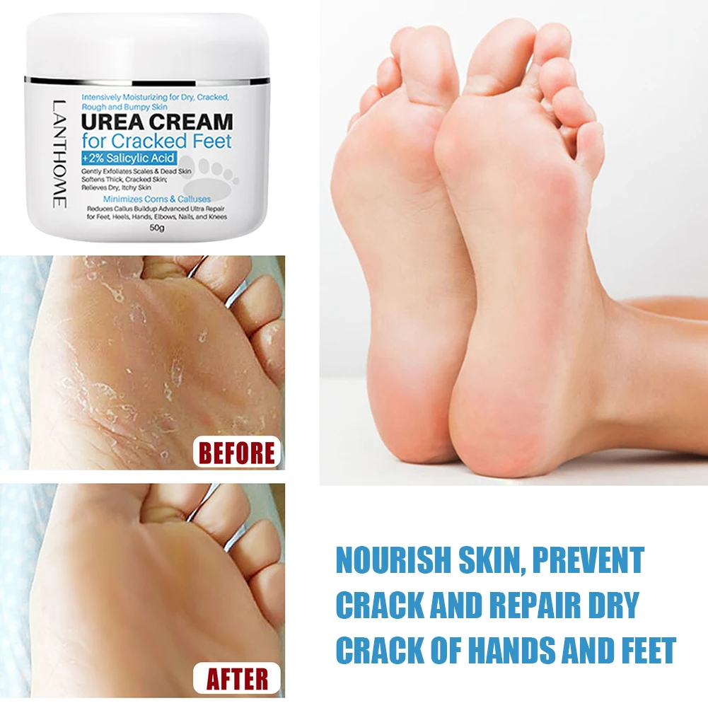 

Hot Sale 50g Urea Cream Foot Repair Cream With Salicylic Acid Dead Skin Cellulite Scal Remover Moisturizing Softening Foot Cream