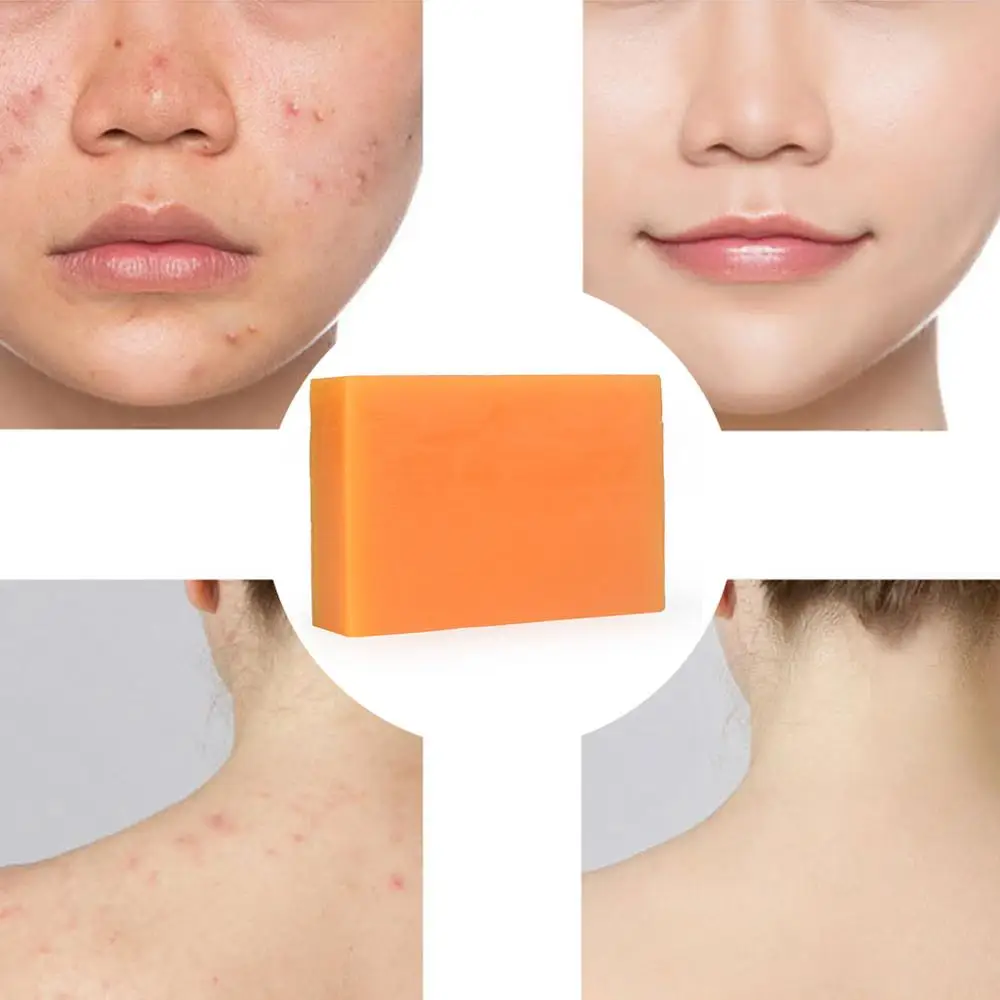 100 г ручной работы Kojic кислотное эфирное масло мыло темное черное отбеливание