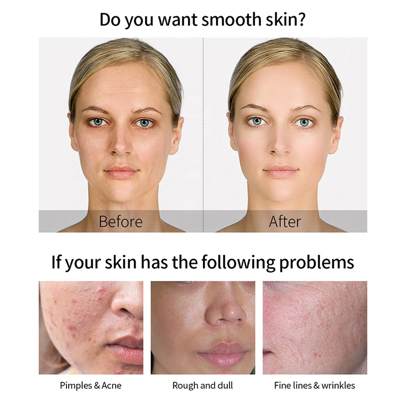 Сыворотка с гиалуроновой кислотой увлажняющий раствор для лица отбеливающий