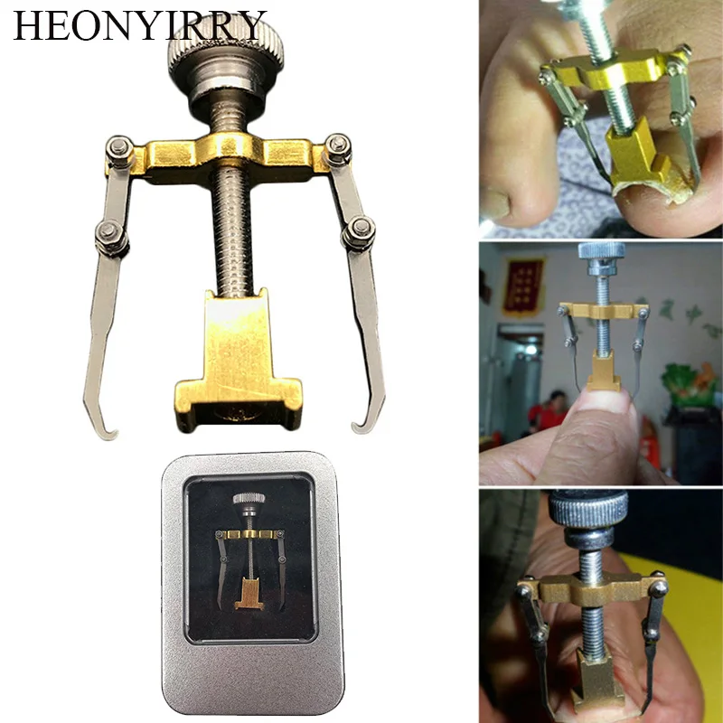 Ingrown Toenails Pedicure Foot Nail Care Tools File for Feet Orthotic Acronyx Ingrowing Onyxis Bunion Corrector Massage |