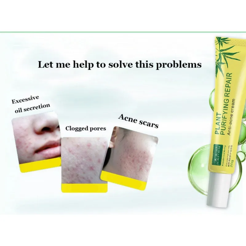 Крем против акне очищающий прыщи быстро анти маска от шрамы ремонт крем для лица