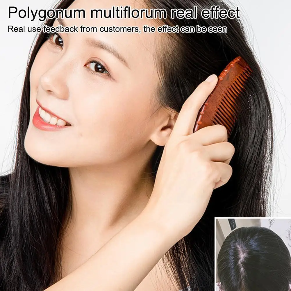 

Polygonum Multiflorum Rolling Ball Essence Hair Care Hair Anti-dropping Massage Oil Liquid Essential Nourishing Nutrient Li G0M0