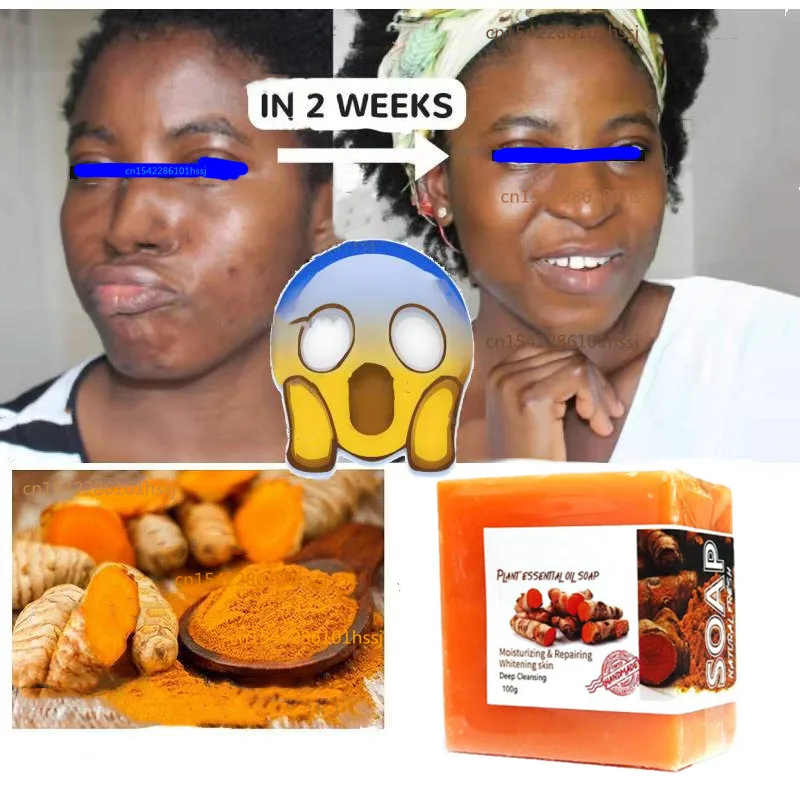 

Tumeric Soap Natural. To Lightening Acne Dark Spots Skin Glow Brighter Scars Removal Bars