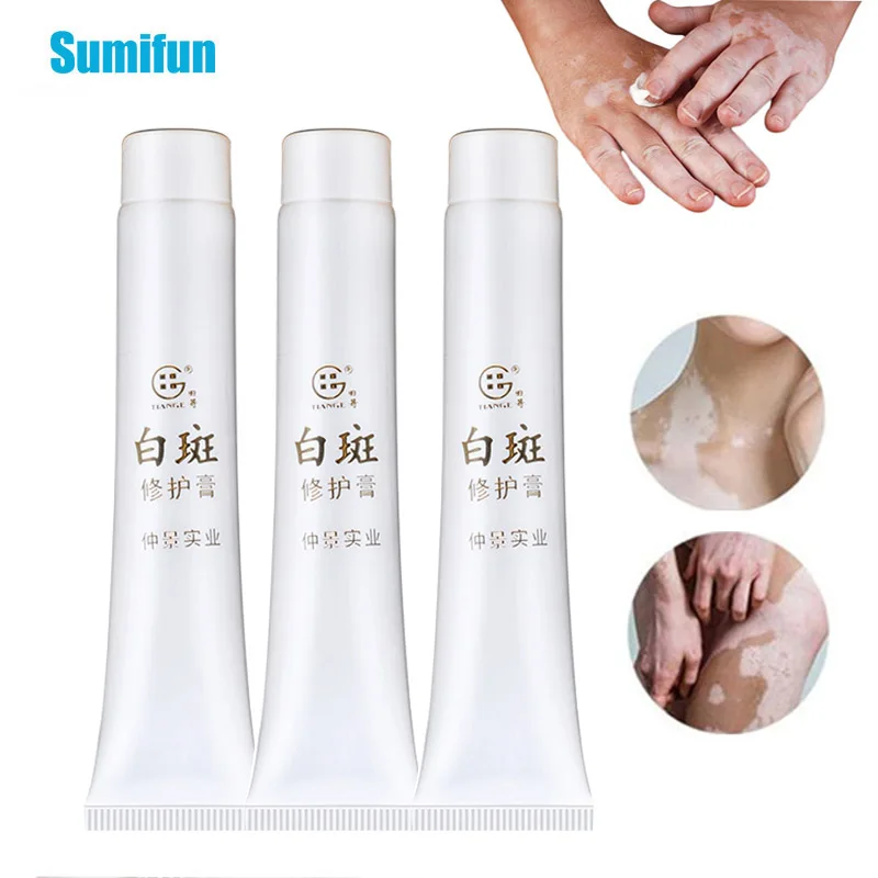 3Pcs Vitiligo Treatment Ointment White Spots Leukoplakia Disease Repair Cream Melanin Promoting Medical Plaster Health Care | Красота и