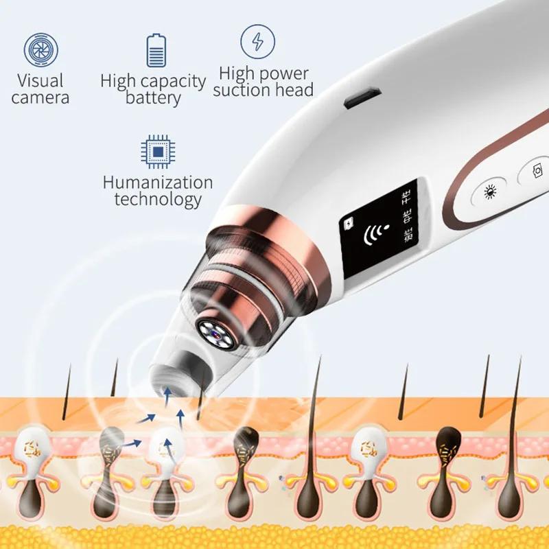 Новое прибытие умный WIFI визуальный Удаление угрей вакуумный очиститель пор
