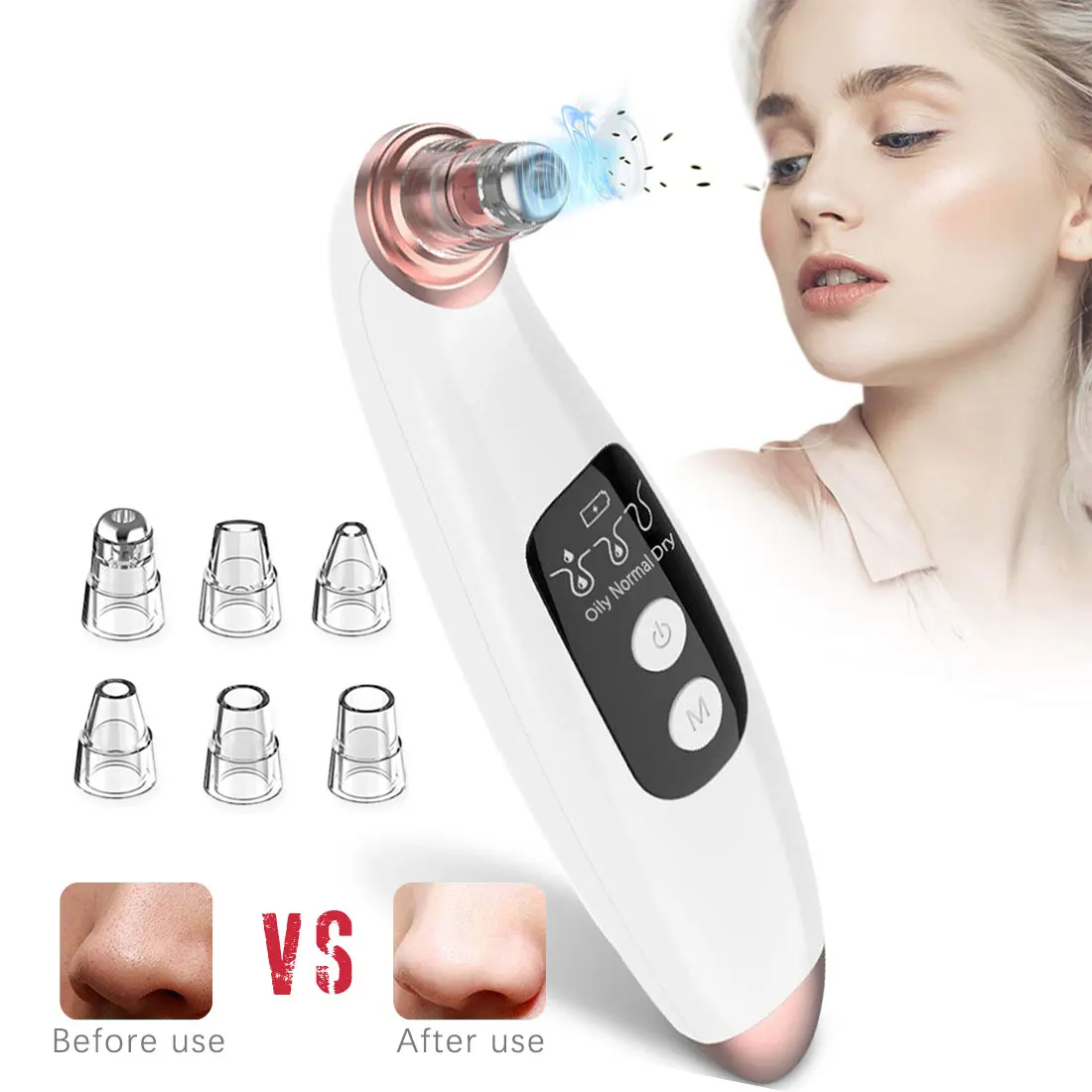 

Blackhead Remover Electric Facial Pore Deep Cleaner Exfoliator Face Blackhead Remover Acne Vacuum Deep Cleansing Suction Machine