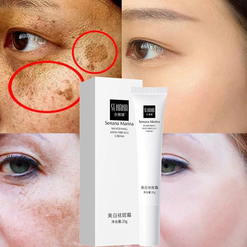 

Effective Whitening Freckle Cream Remove Dark Spots Anti Freckle Cream Skin Care 1Pcs
