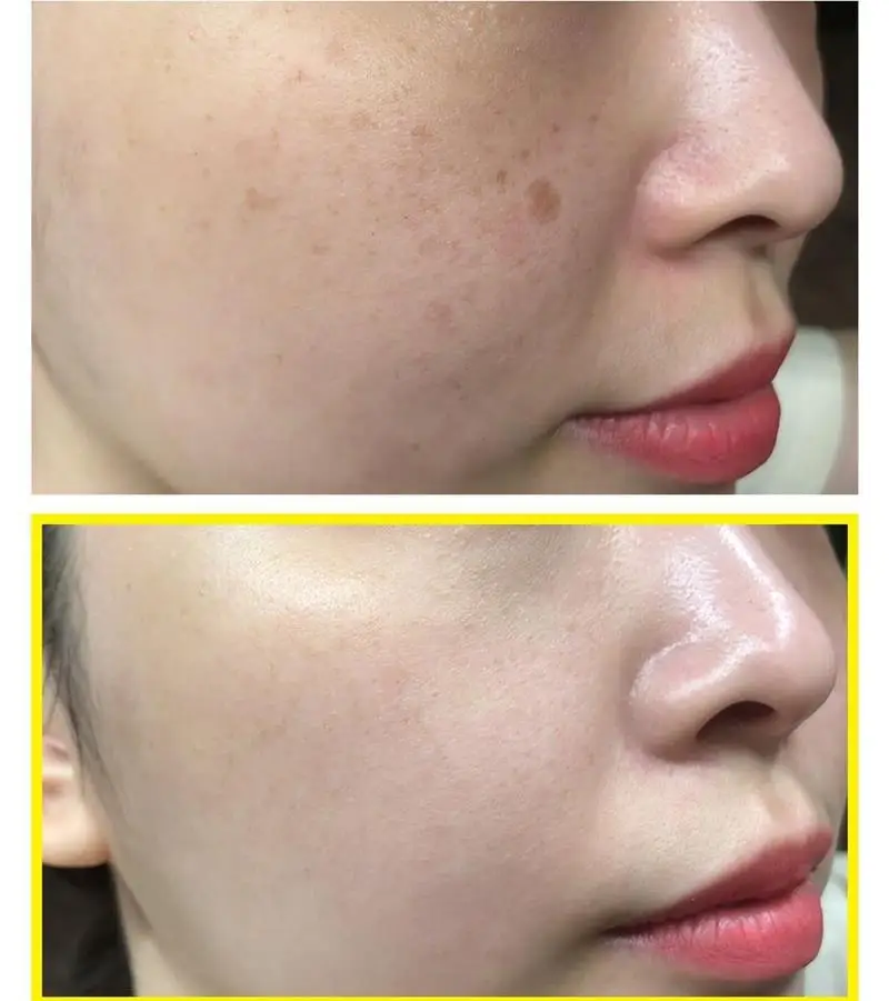 

SOME BY MI Yuja Niacin Brightening Sleeping Mask Facial Whitening Freckle Cream Face Mask Acne Spots Melanin Blackhead Remove