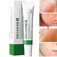 20g effective whitening freckle cream remove melasma dark spots effective acne removal cream acne treatment fade acne spots oil