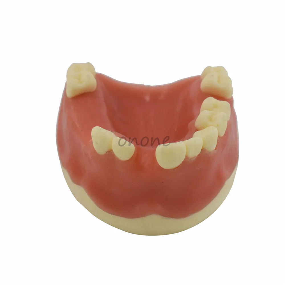 1 шт. вспомогательные средства для обучения зубам и имитации зубных имплантатов