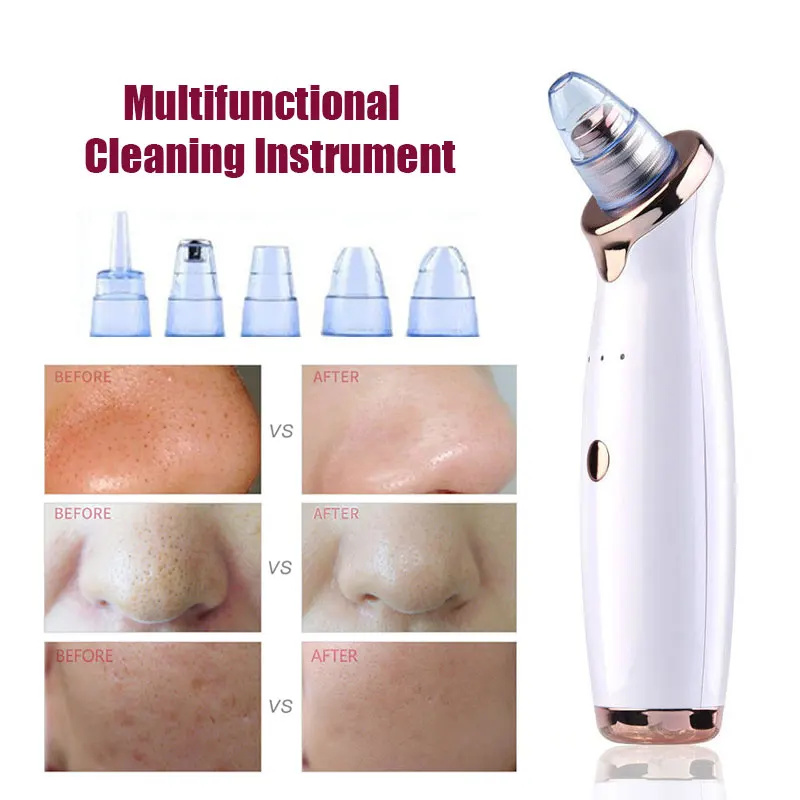 

Facial Blackhead Remover Tool Electric Acne Black Dot Pimple Dead Skin Remover Face Pore Vacuum Cleaner Skin Care Machine