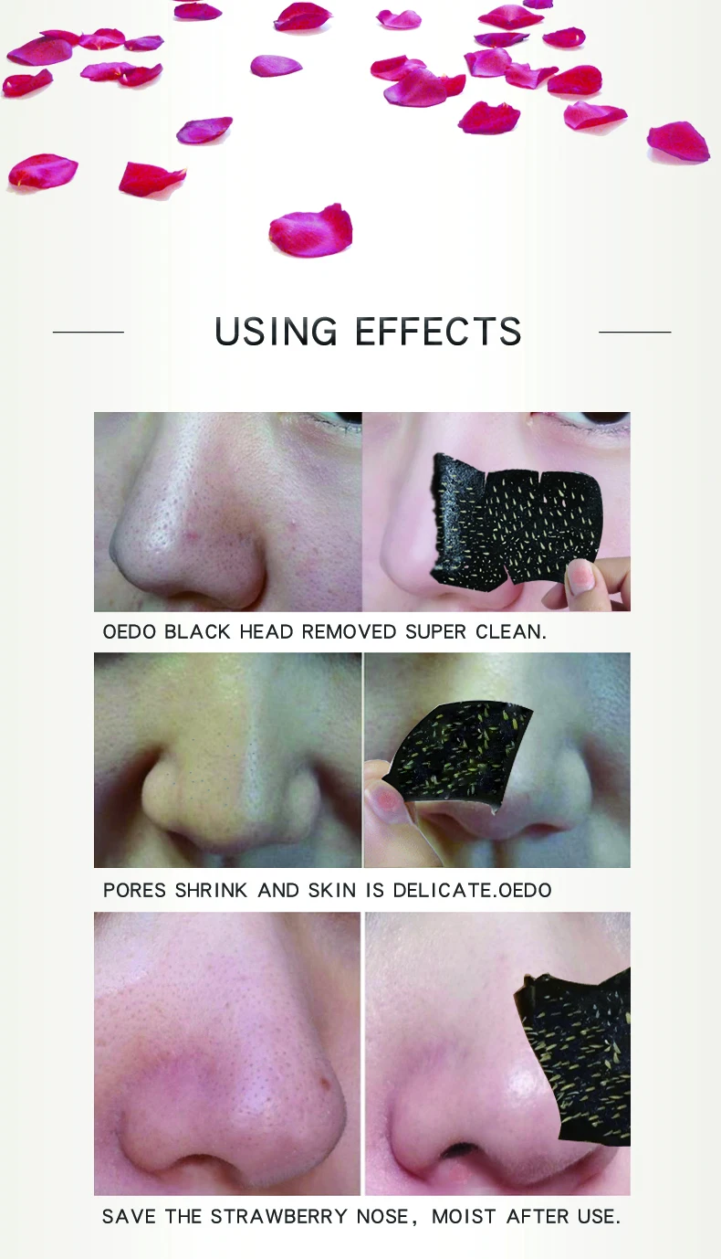 10PCSRose Peptides маска для удаления угрей маска для носа лечение пор черная маска пилинг черная голова чистая для ухода за кожей лица Mas